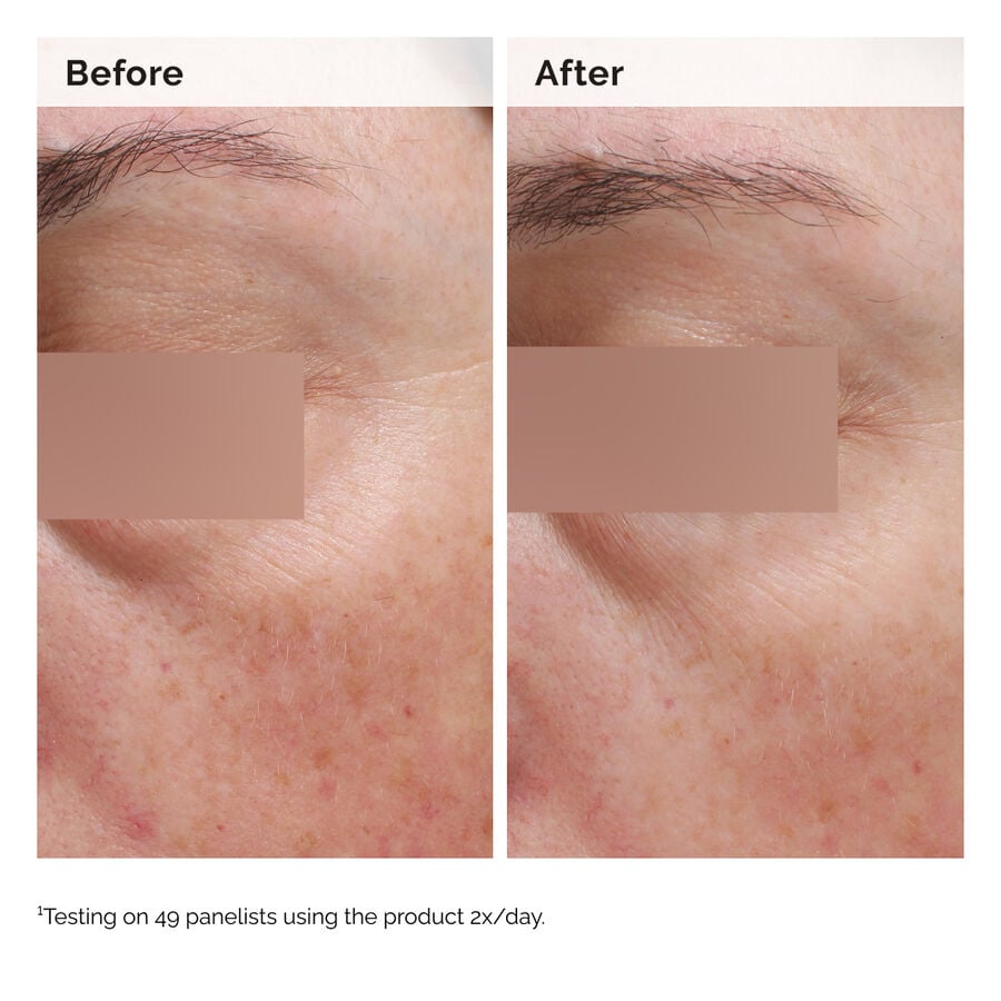 Niacinamide 5% Face and Body Emulsion - US 6584