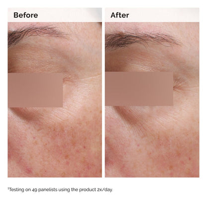 Niacinamide 5% Face and Body Emulsion - US 6584