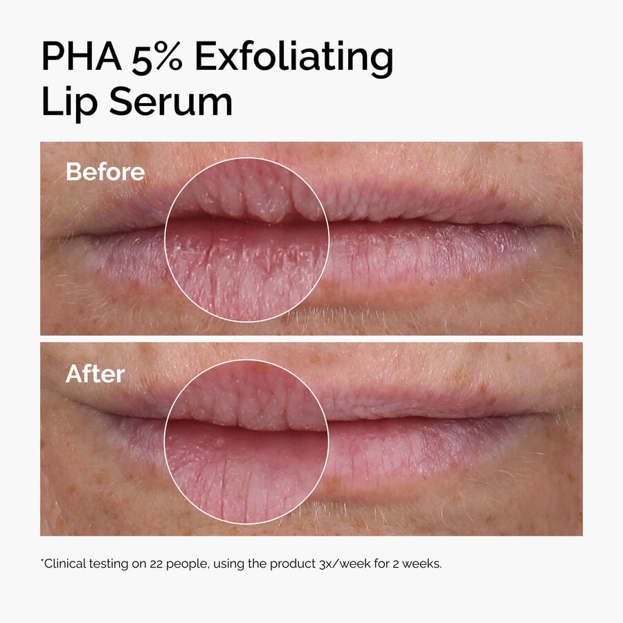PHA 5% Exfoliating Lip Serum - US 1845