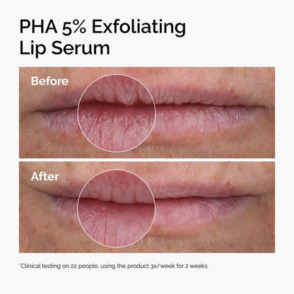 PHA 5% Exfoliating Lip Serum - US 1845