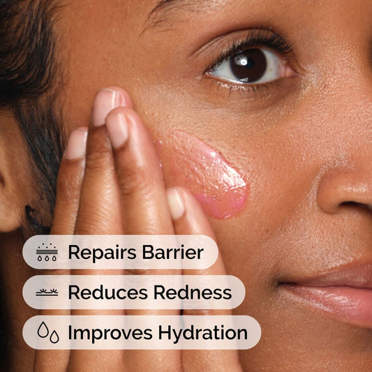 Soothing &amp; Barrier Support Serum - US 7531
